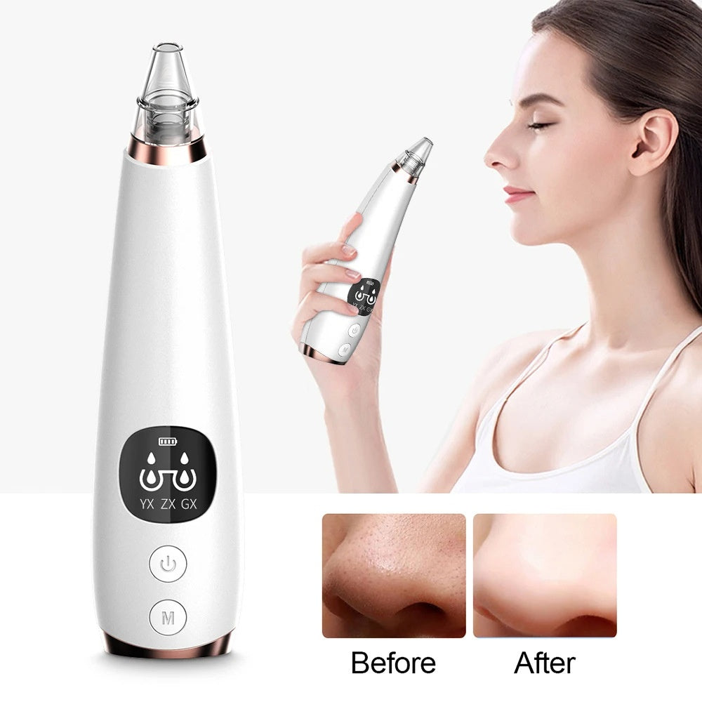 Aspirateur Points Noirs Électrique USB - Nettoyage Professionnel Pores